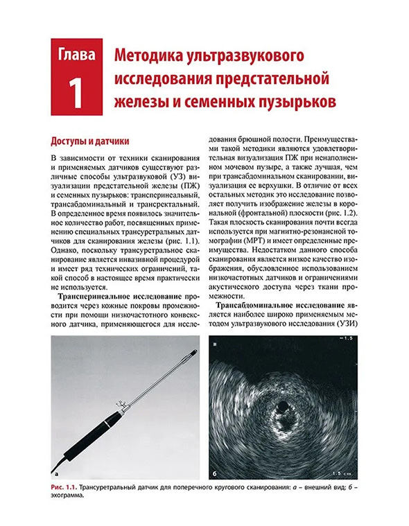 Трансуретальный датчик для поперечного кругового сканирования Трансуретальный датчик для поперечного кругового сканирования