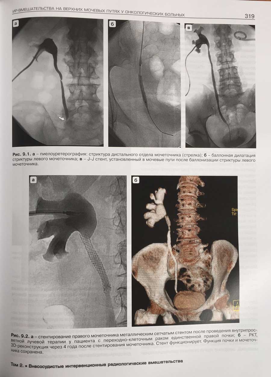 Примеры страниц из книги "Интервенционная радиология в онкологии. Национальное руководство"