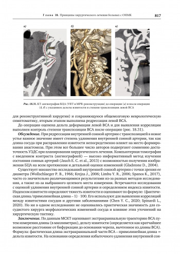 Пример страницы из книги "Церебральная ангионеврология" - Скоромец А. А., Амелин А. В., Баранцевич Е. Р., Вознюк И. А.