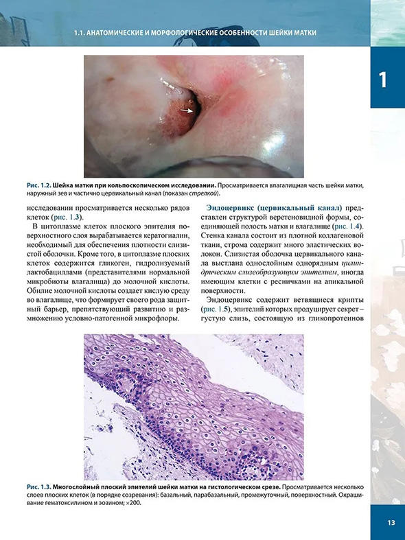 Многослойный плоский эпителий шейки матки на гистологическом срезе. Многослойный плоский эпителий шейки матки на гистологическом срезе.