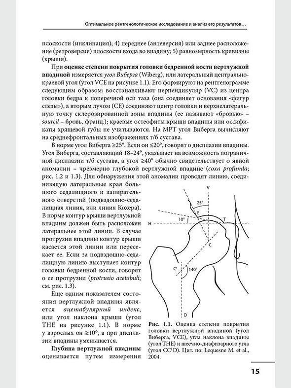 Оценка степени покрытия головки вертлужной впадиной Оценка степени покрытия головки вертлужной впадиной