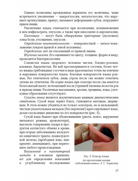 Осмотр языка