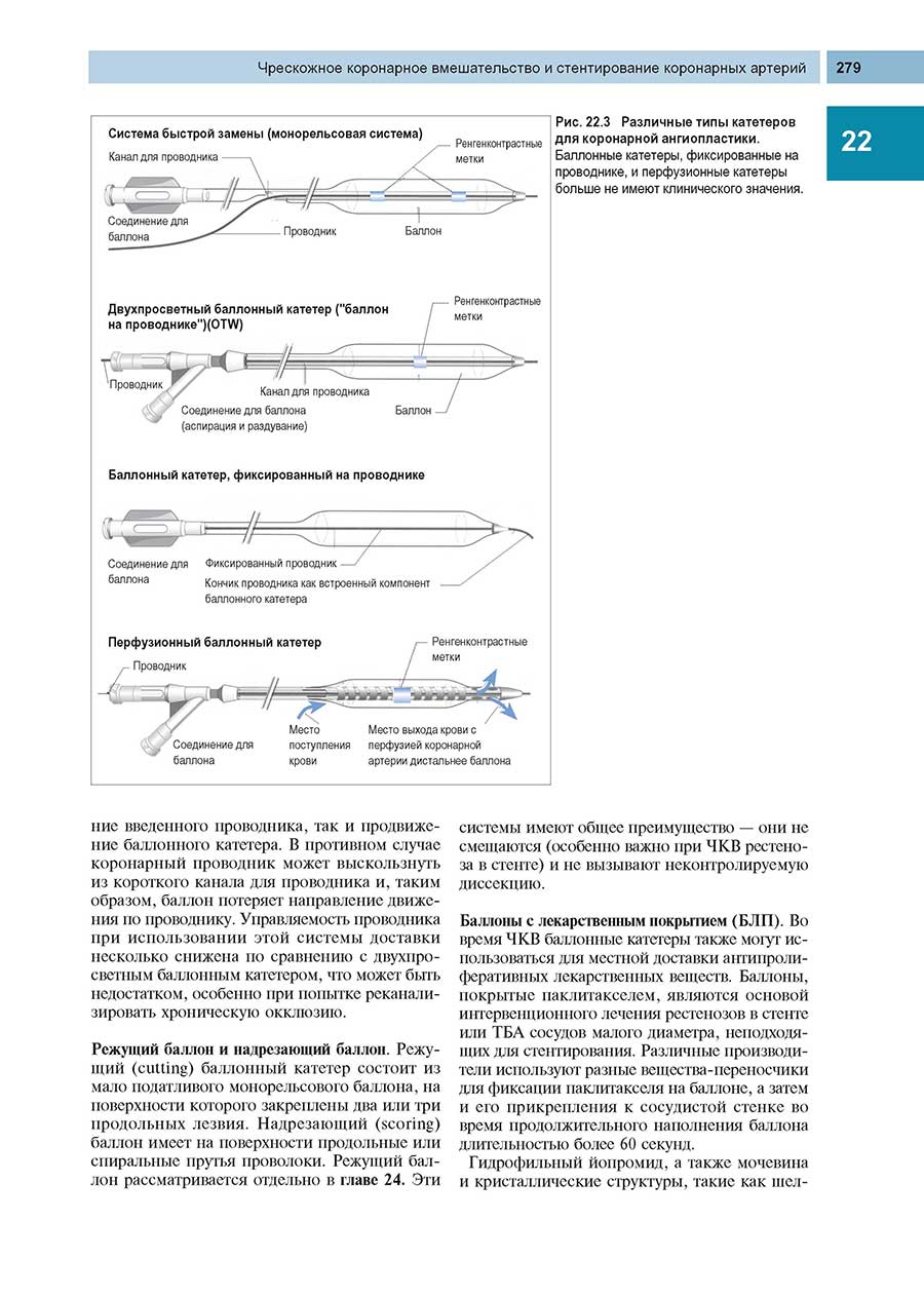 Рис. 22.3 Различные типы катетеров для коронарной ангиопластики.