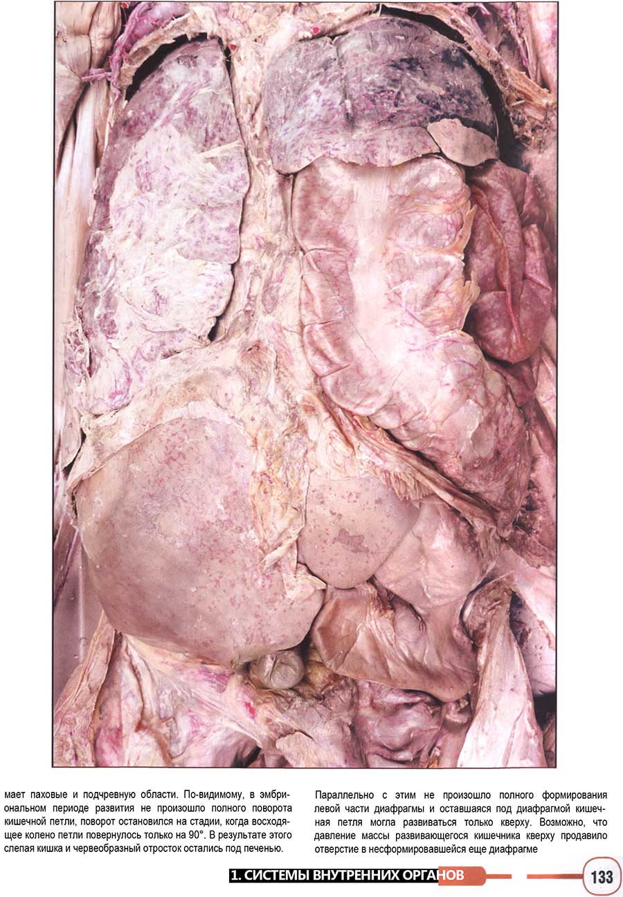 Примеры страниц из книги "Анатомия человека. Фотографический атлас. Том 3. Внутренние органы. Нервная система"