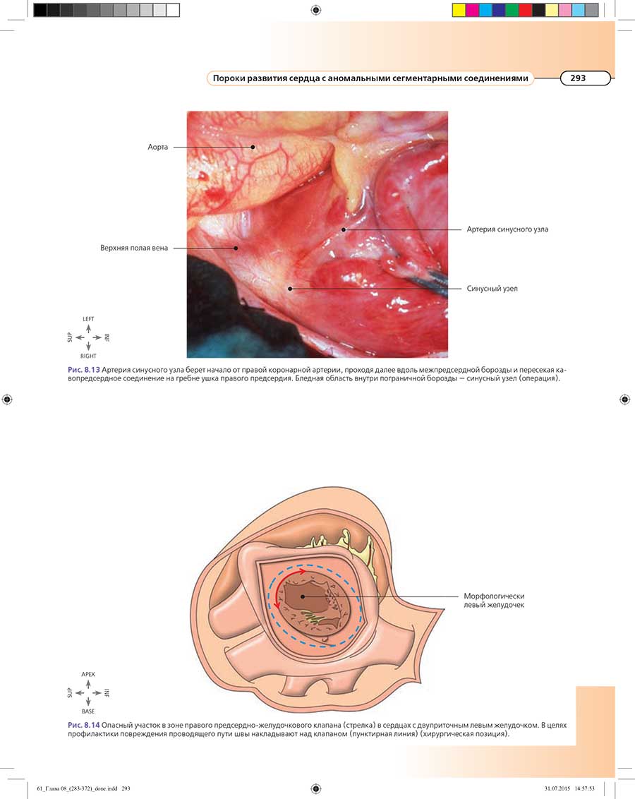 Рис. 8.13 Артерия синусного узла берет начало от правой коронарной артерии.