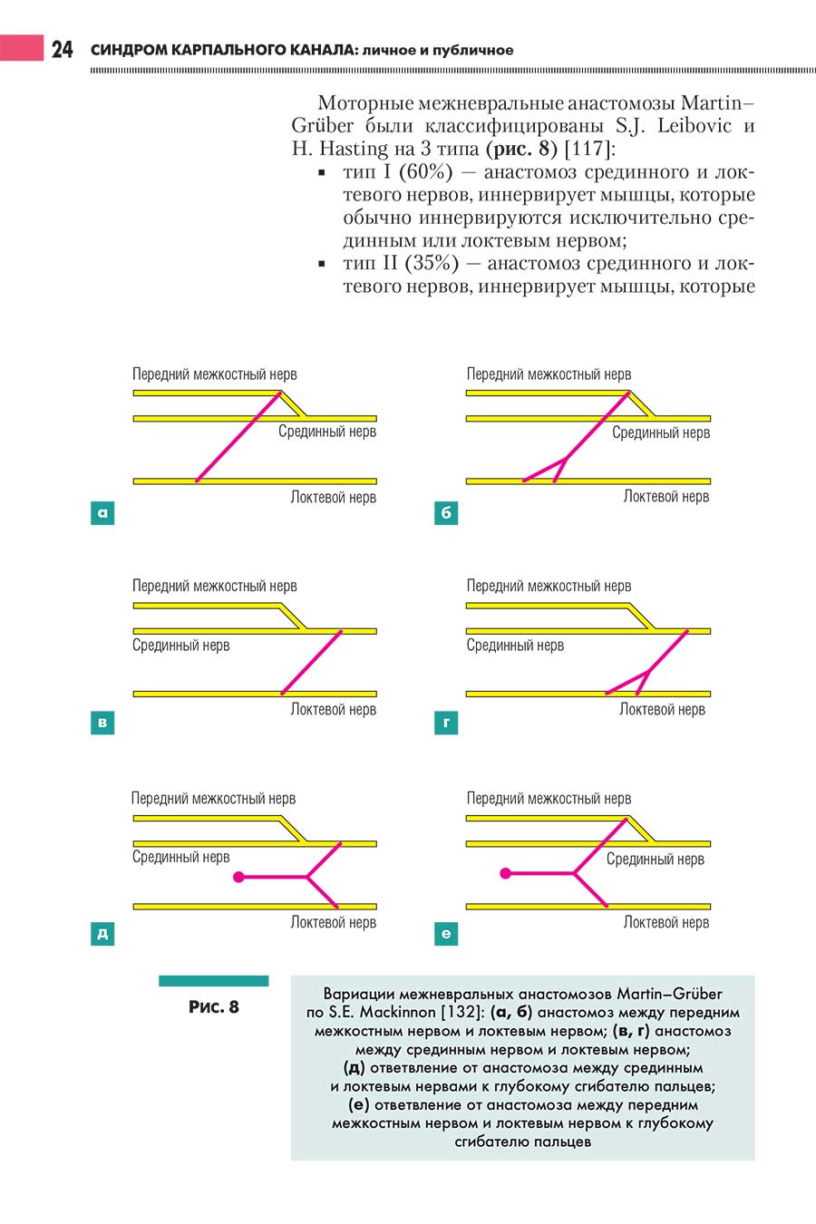 Вариации межневральных анастомозов Martin-Gruber
