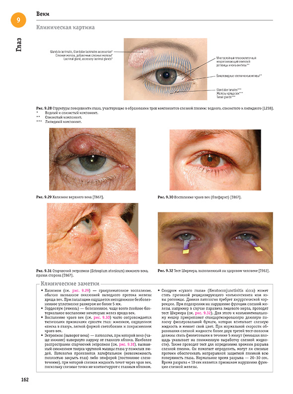  Старческий эктропион