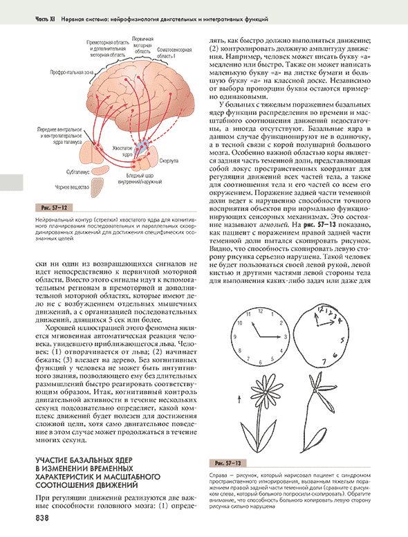 Рисунок, который нарисовал пациент с синдромом пространственного игнорирования, вызванным тяжелым поражением правой задней части