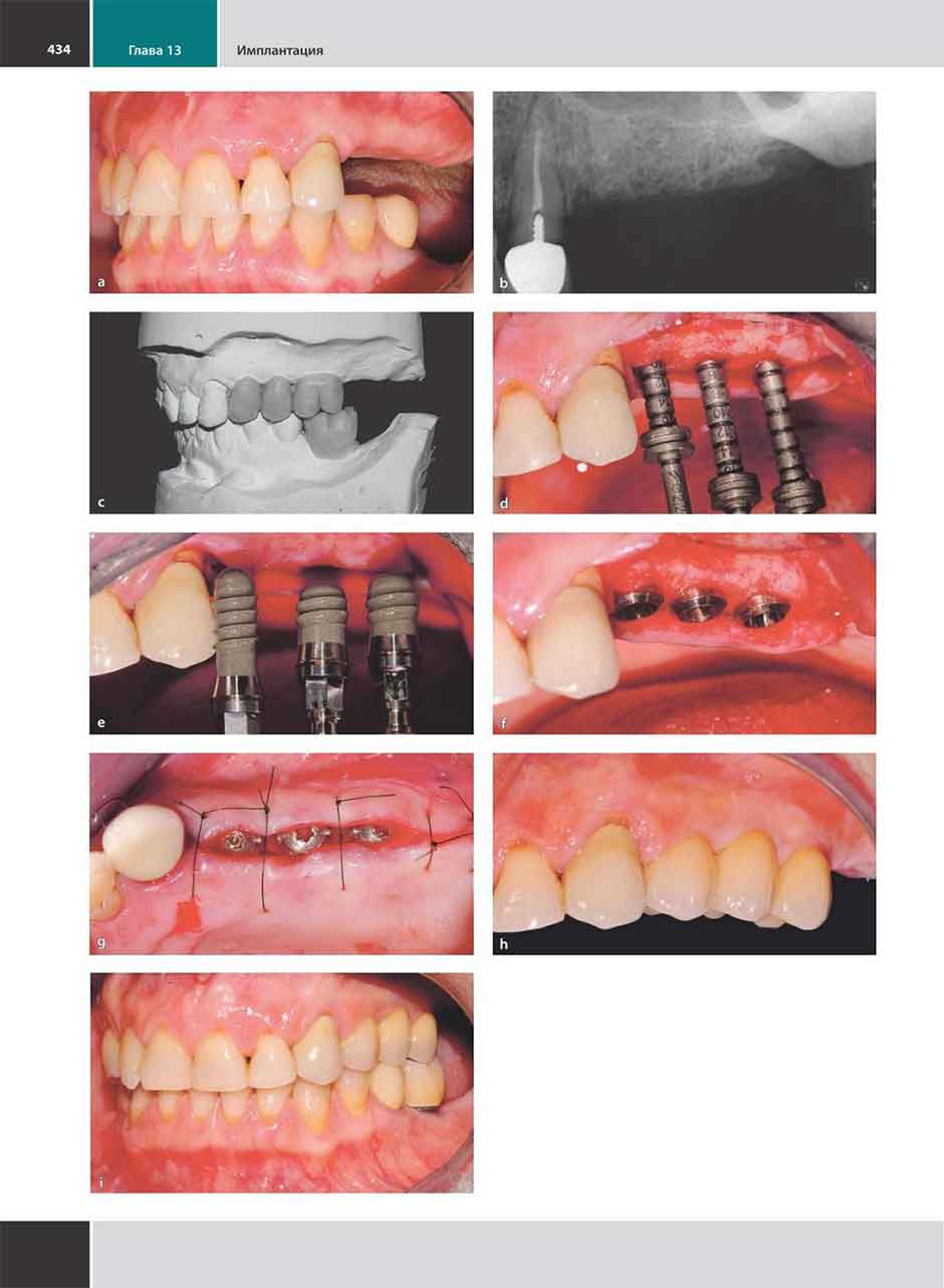 Примеры страниц из книги "Хирургическая стоматология. Клинические протоколы" - Маттео Кьяпаско