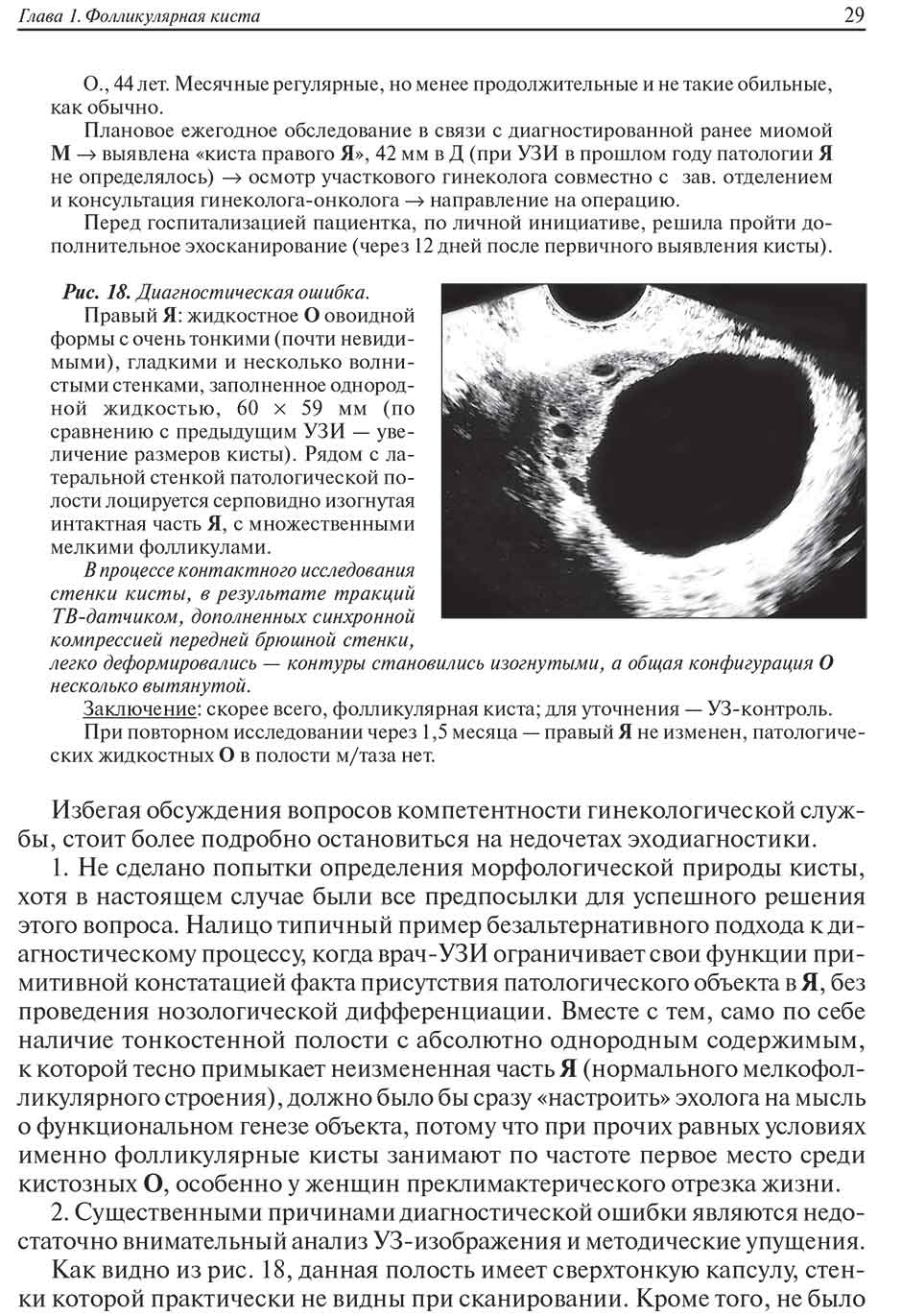 Пример страницы из книги "Ультразвуковая симптоматика и дифференциальная диагностика кист и опухолей яичников" - Хачкурузов С. Г.