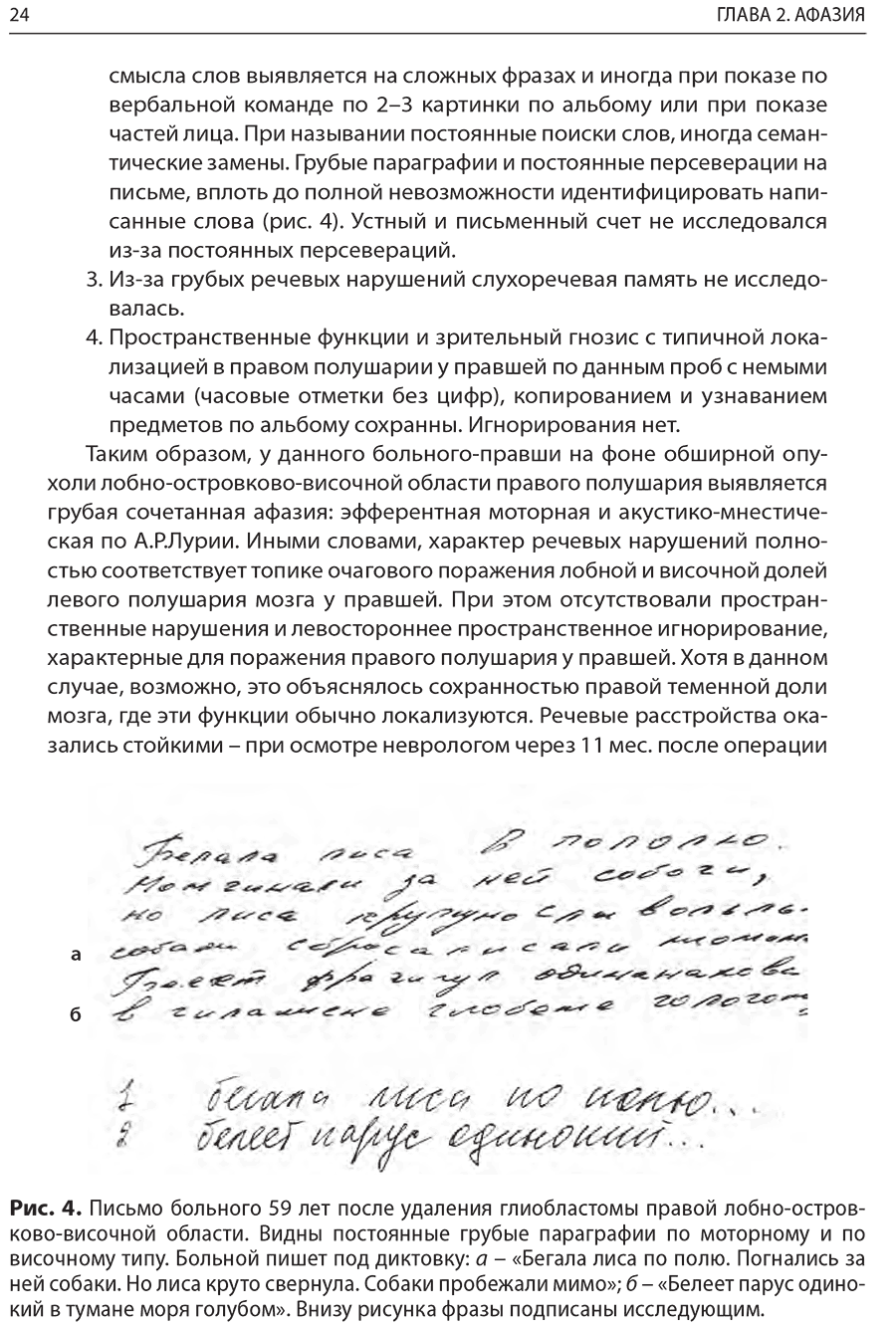 Рис. 4. Письмо больного 59 лет после удаления глиобластомы