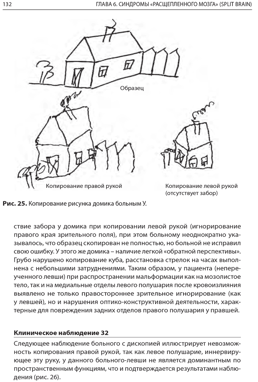 Рис. 25. Копирование рисунка домика больным У.