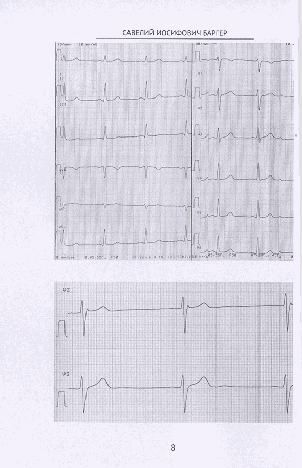 Пример страницы из книги "Алгоритм ЭКГ-диагностики" - С. И. Баргер