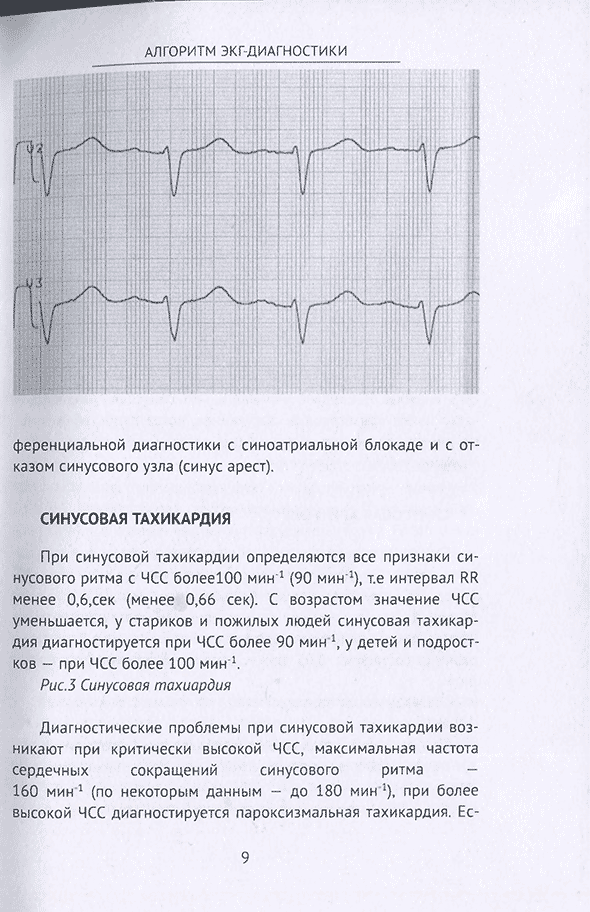Пример страницы из книги "Алгоритм ЭКГ-диагностики" - С. И. Баргер