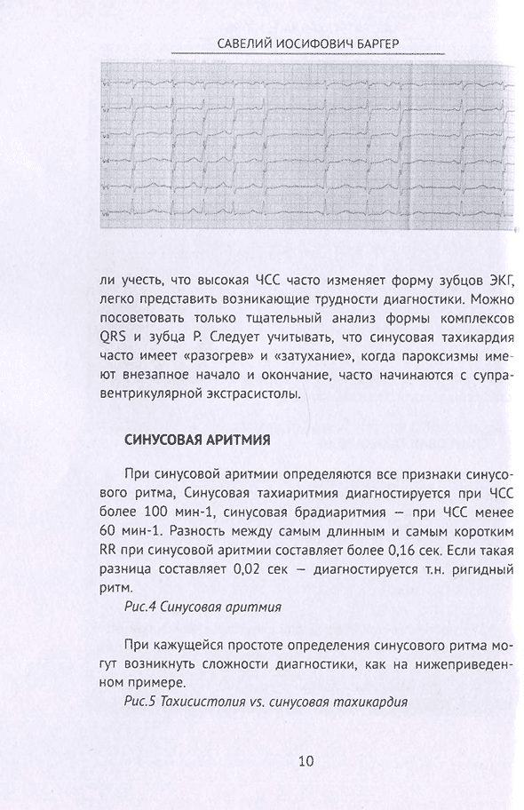 Пример страницы из книги "Алгоритм ЭКГ-диагностики" - С. И. Баргер