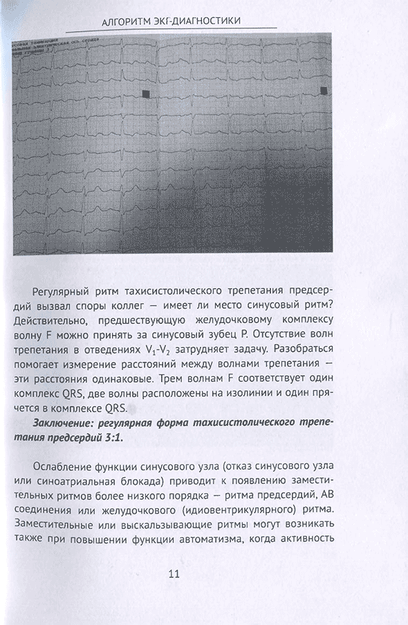 Пример страницы из книги "Алгоритм ЭКГ-диагностики" - С. И. Баргер
