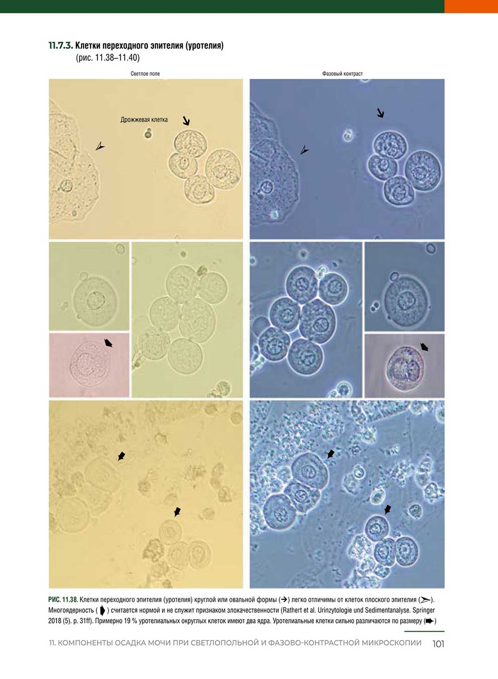 . Клетки переходного эпителия (уротелия) круглой или овальной формы