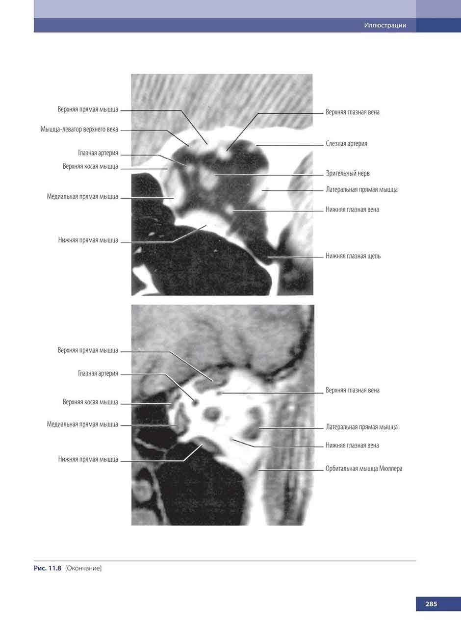 Пример страницы из книги "Атлас клинической анатомии глазницы" - Даттон Дж.Дж.