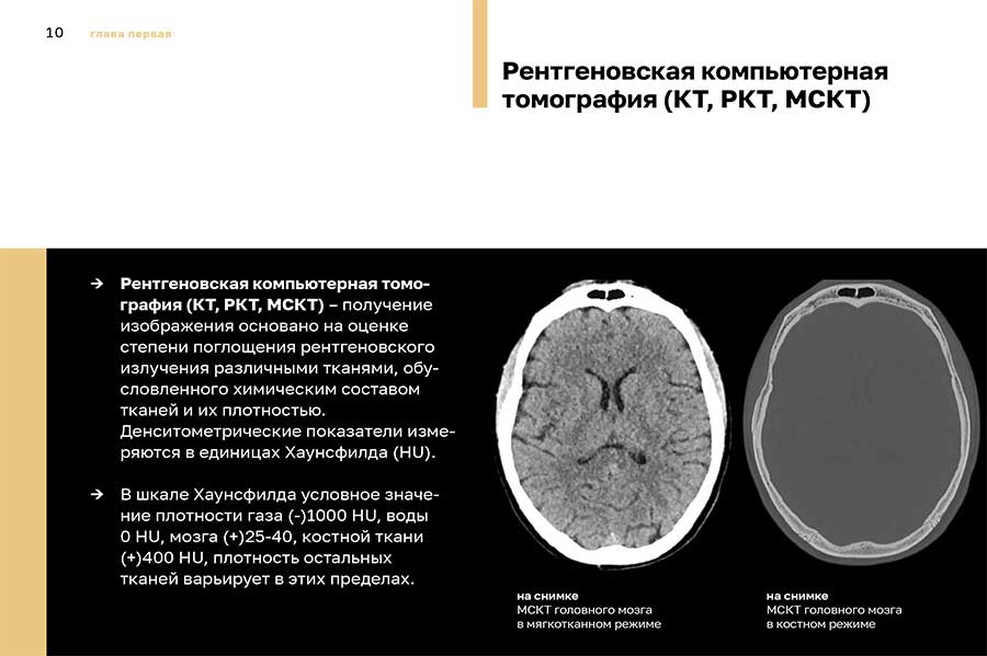 Рентгеновская компьютерная томография (КТ, PKT, МСКТ)
