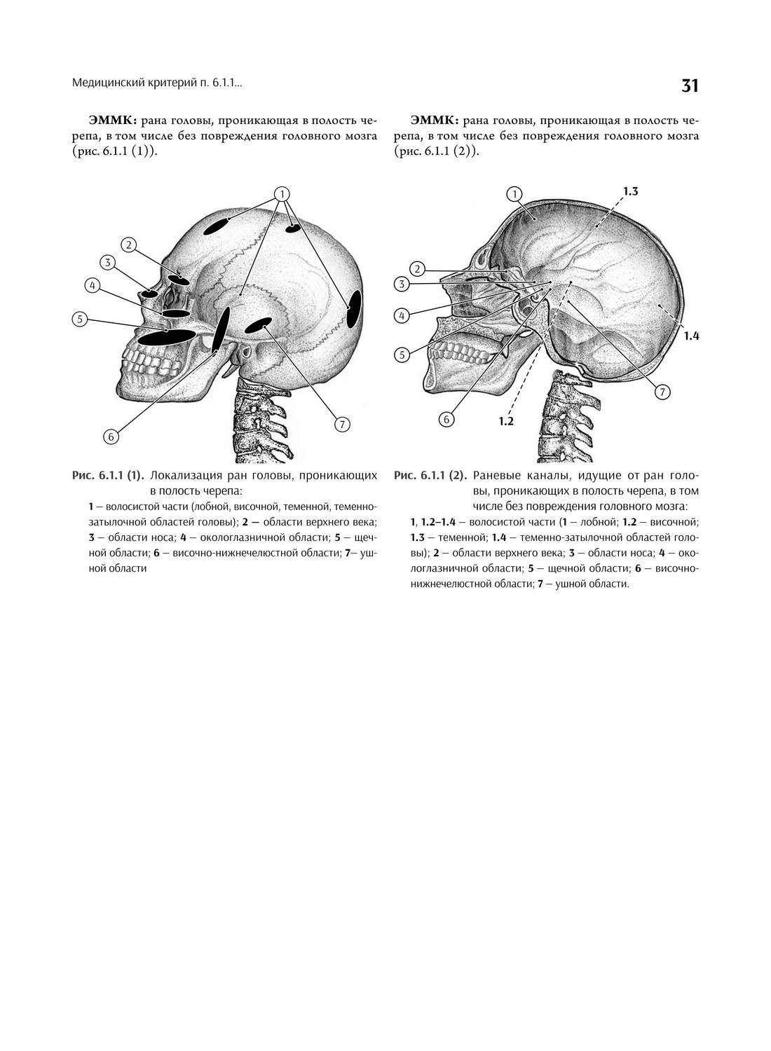 Рис. 6.1.1 (1). Локализация ран головы, проникающих в полость черепа