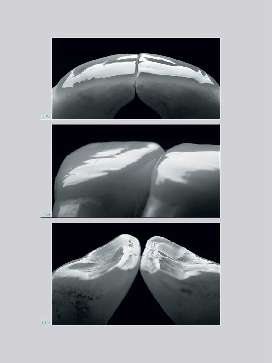 Пример страницы к книге "Адгезивные керамические реставрации передних зубов" - Манье П.
