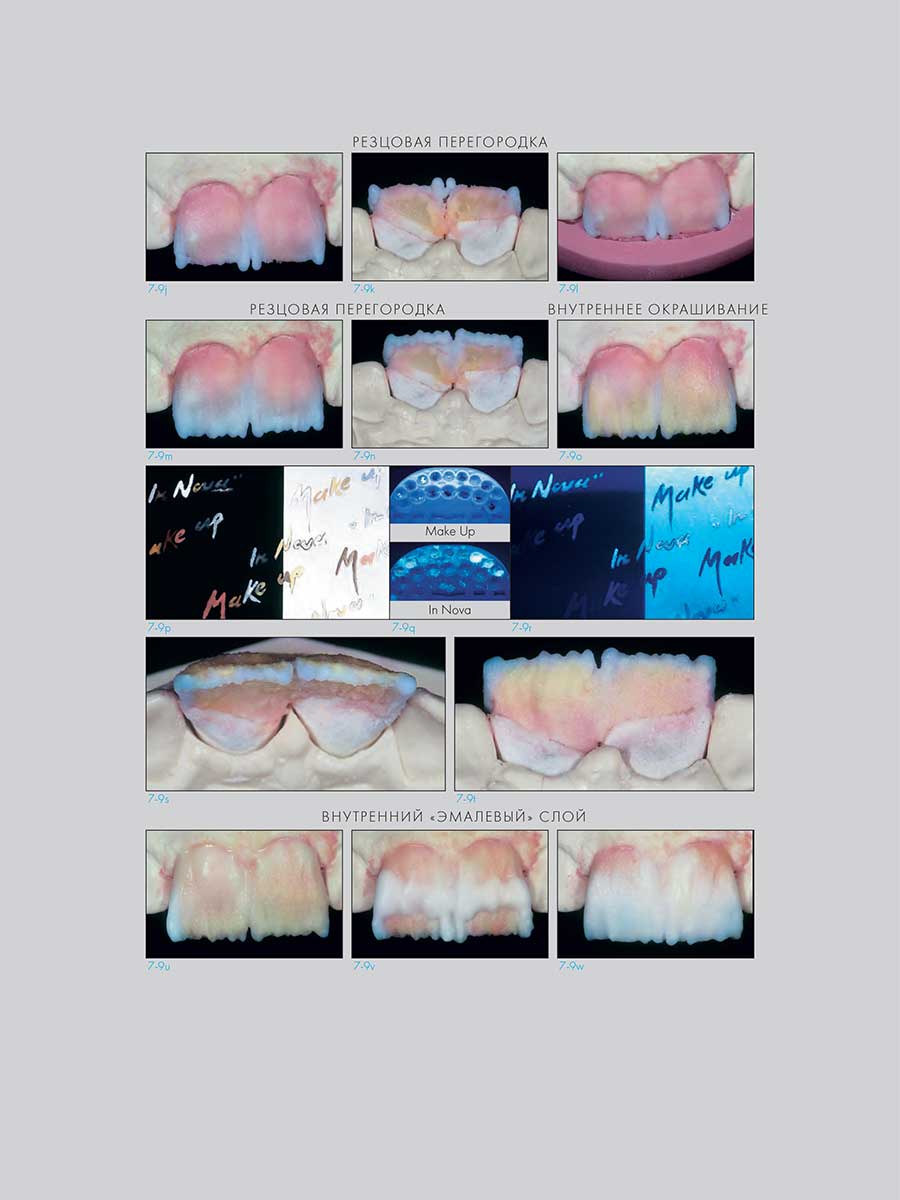Пример страницы к книге "Адгезивные керамические реставрации передних зубов" - Манье П.
