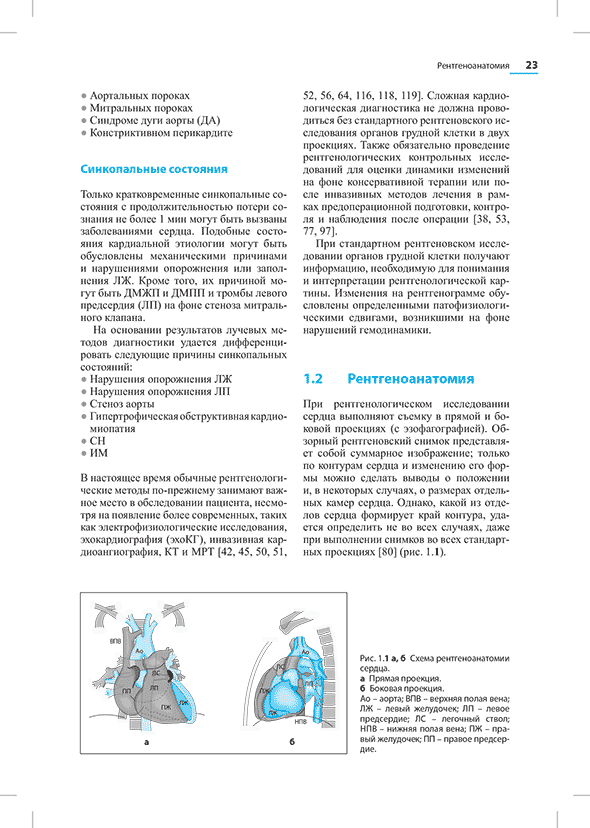 Схема рентгеноанатомии сердца.
