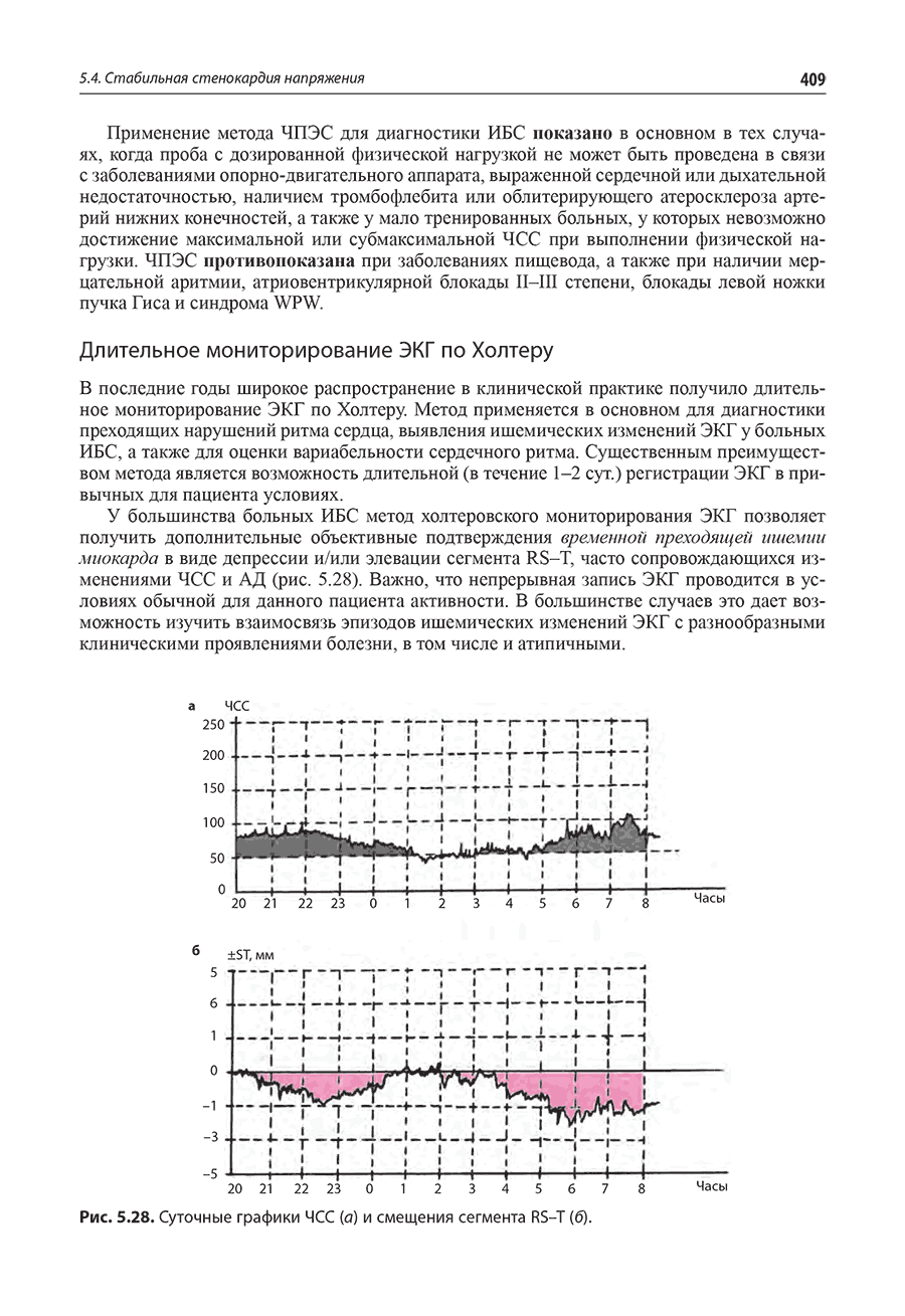 Рис. 5.28. Суточные графики ЧСС (а) и смещения сегмента RS-T