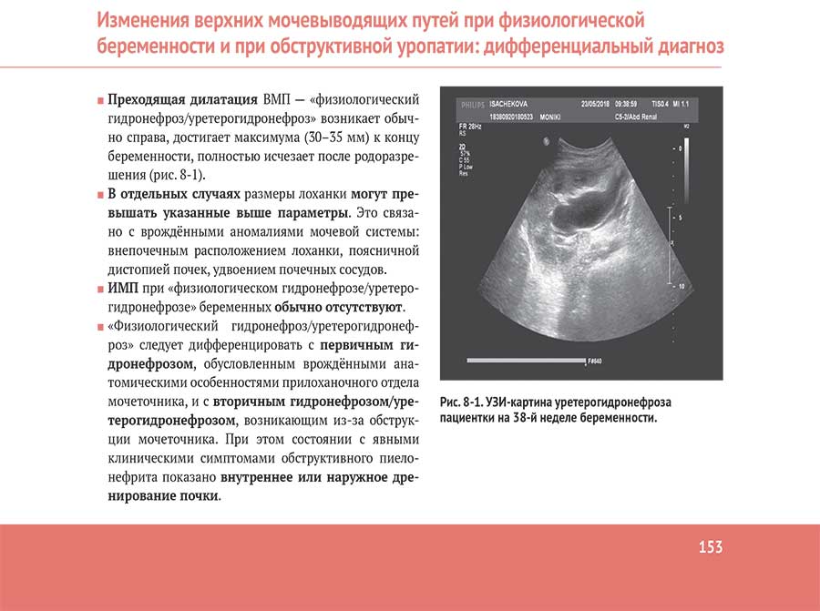 Изменения верхних мочевыводящих путей при физиологической беременности и при обструктивной уропатии: дифференциальный диагноз