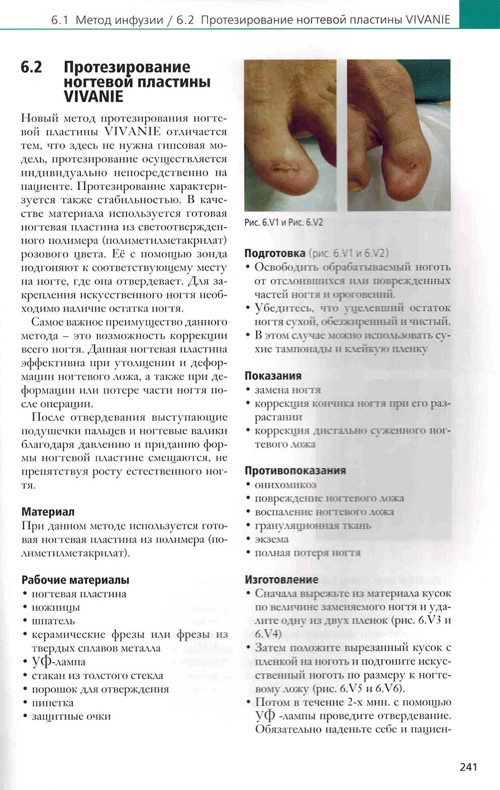 Протезирование ногтевой пластины VIVANIE