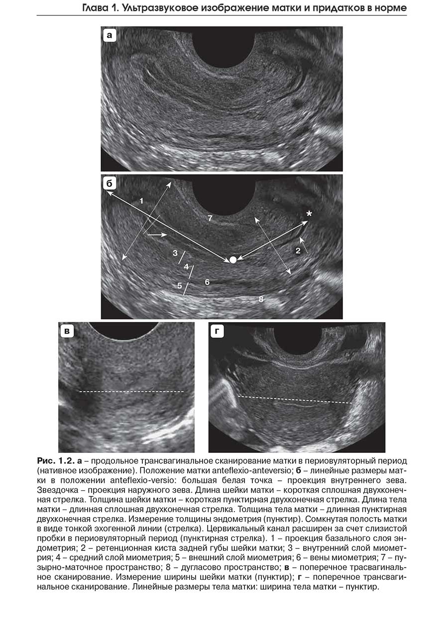 Рис. 1.2. а - продольное трансвагинальное сканирование матки в периовуляторный период