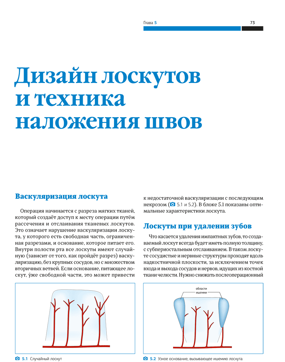 Узкое основание, вызывающее ишемию лоскута