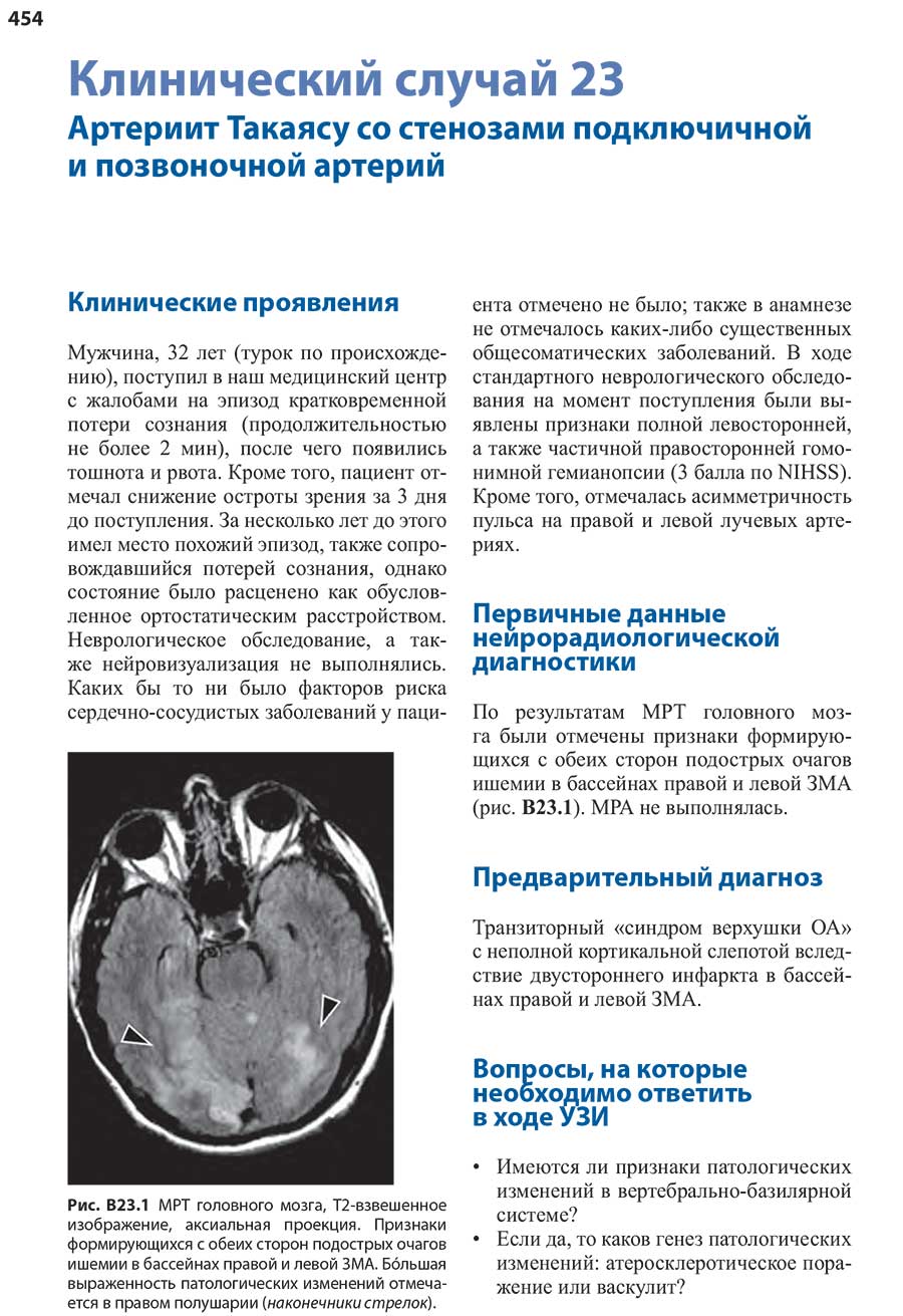 Рис. В23.1 MPT головного мозга, Т2-взвешенное