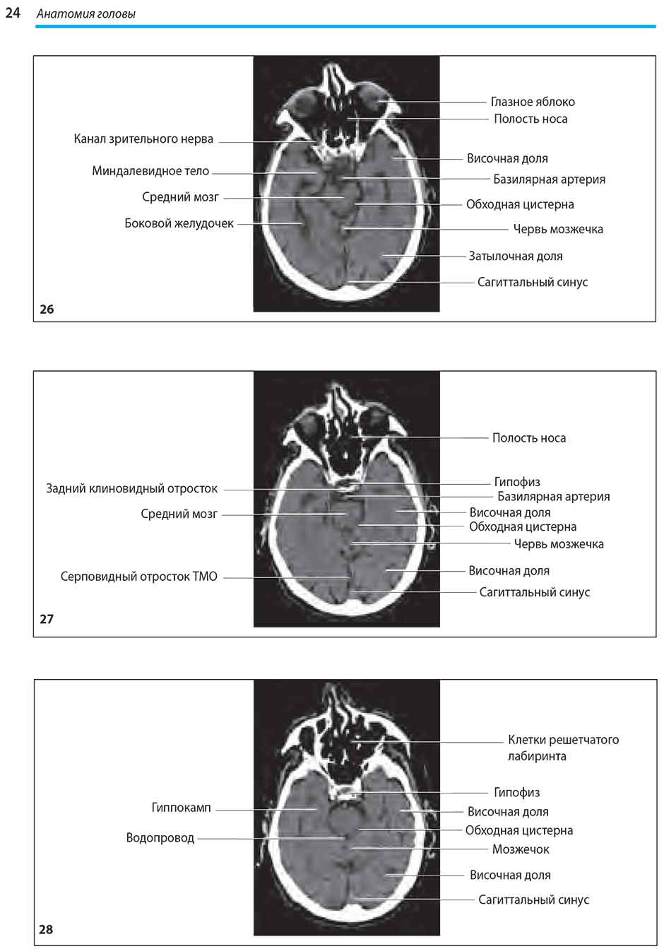 Пример страницы из книги "Компьютерная томография головы и позвоночника" - Хостен Норберт