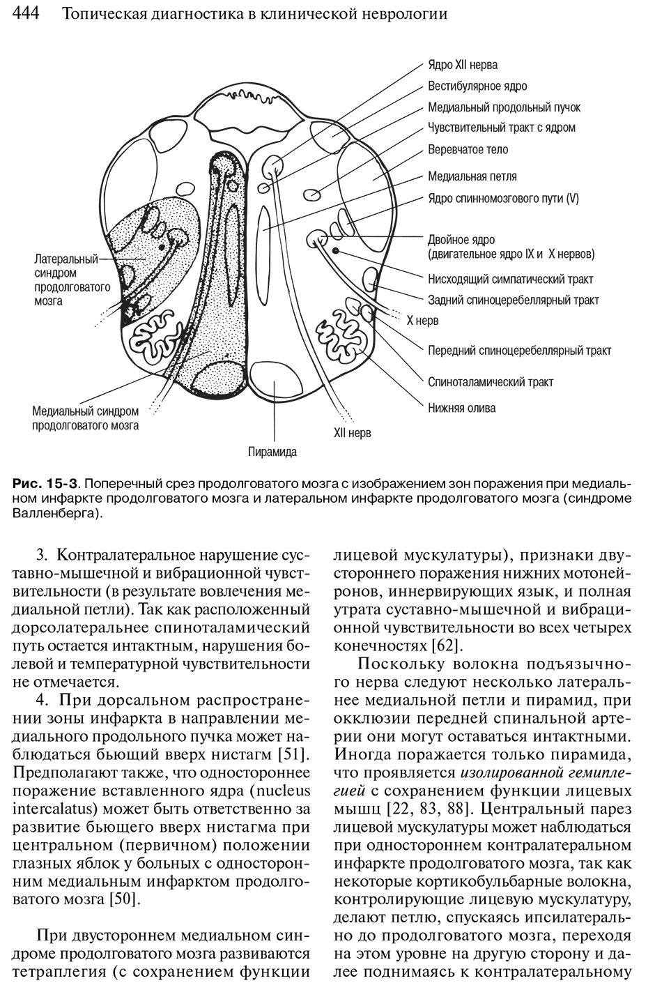 Рис. 15-3. Поперечный срез продолговатого мозга с изображением зон г