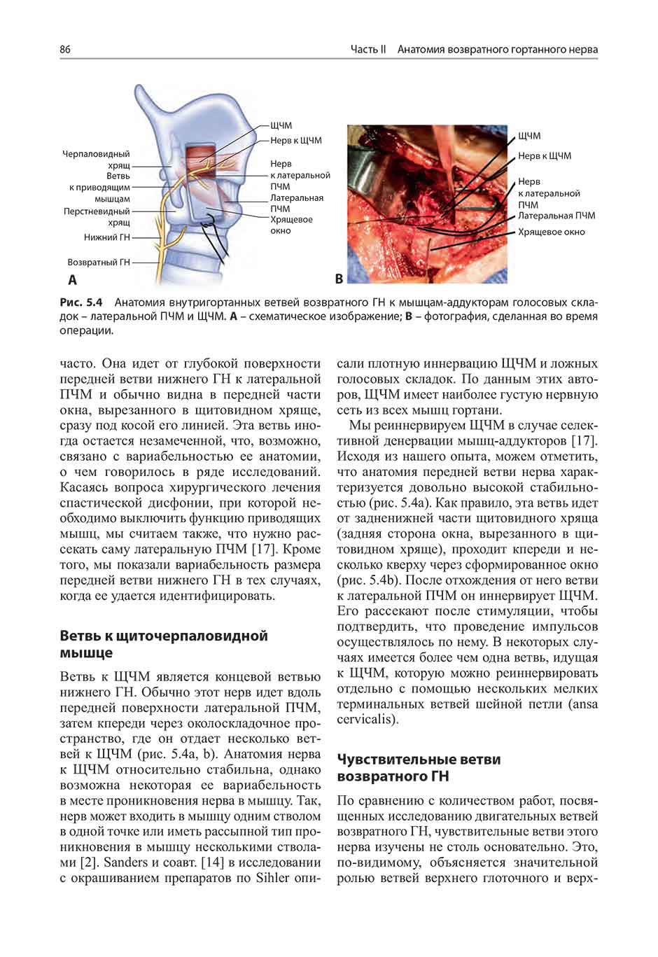 Рис. 5.4 Анатомия внутригортанных ветвей возвратного ГН к мышцам-аддукторам