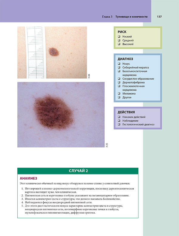 Пример страницы из книги "Дерматоскопия. Иллюстрированное руководство для самообучения" - Хор Р. Х. Пример страницы из книги "Дерматоскопия. Иллюстрированное руководство для самообучения" - Хор Р. Х.