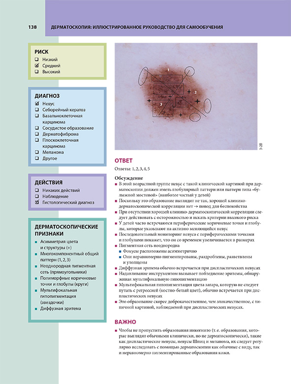 Пример страницы из книги "Дерматоскопия. Иллюстрированное руководство для самообучения" - Хор Р. Х. Пример страницы из книги "Дерматоскопия. Иллюстрированное руководство для самообучения" - Хор Р. Х.