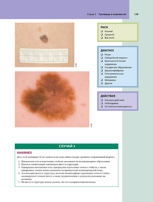 Пример страницы из книги "Дерматоскопия. Иллюстрированное руководство для самообучения" - Хор Р. Х. Пример страницы из книги "Дерматоскопия. Иллюстрированное руководство для самообучения" - Хор Р. Х.