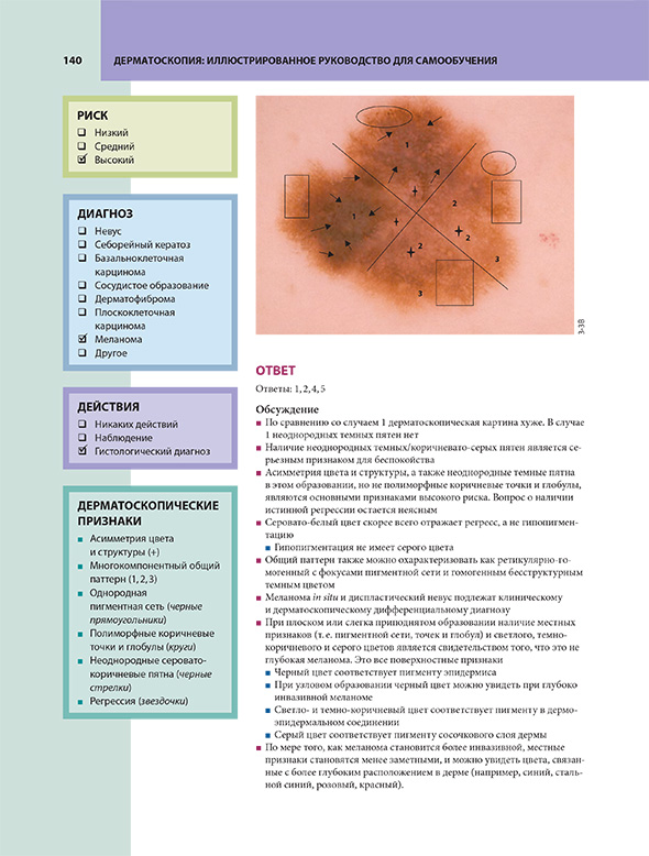 Пример страницы из книги "Дерматоскопия. Иллюстрированное руководство для самообучения" - Хор Р. Х. Пример страницы из книги "Дерматоскопия. Иллюстрированное руководство для самообучения" - Хор Р. Х.