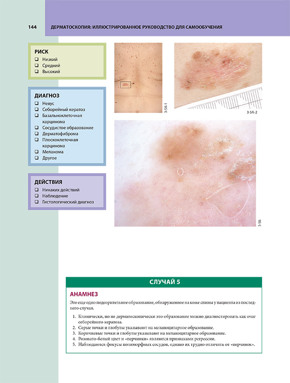 Пример страницы из книги "Дерматоскопия. Иллюстрированное руководство для самообучения" - Хор Р. Х. Пример страницы из книги "Дерматоскопия. Иллюстрированное руководство для самообучения" - Хор Р. Х.