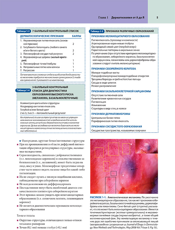 Амеланотическая меланома Амеланотическая меланома