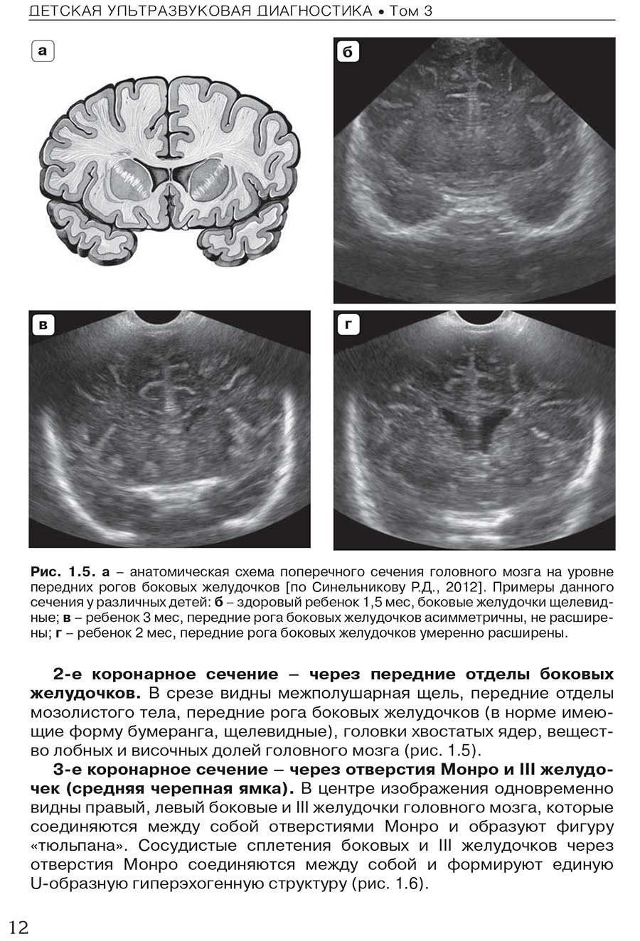 Рис. 1.5. а - анатомическая схема поперечного сечения головного мозга