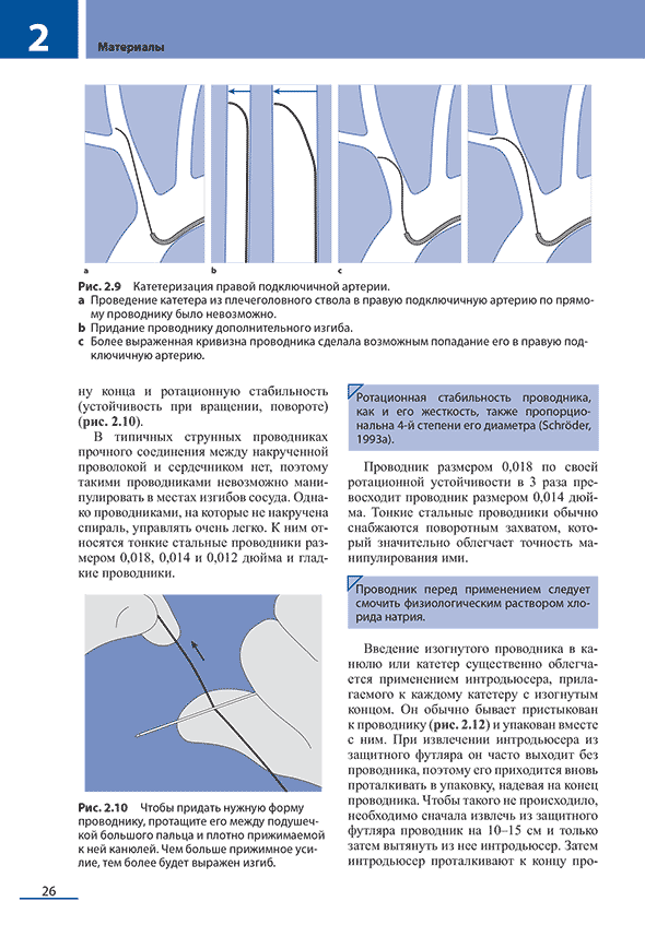 Катетеризация правой подключичной артерии