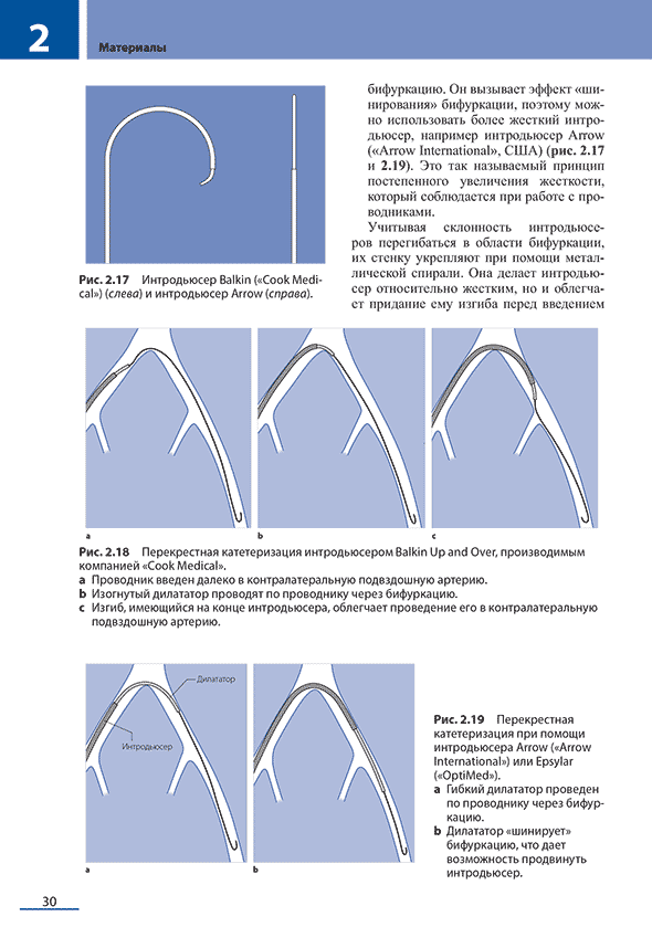 Перекрестная катетеризация интродьюсером Balkin Up and Over.