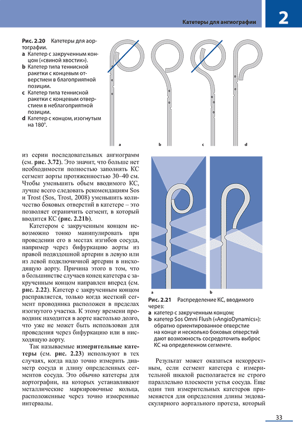 Рис. 2.21 Распределение КС, вводимого через: а катетер с закрученным концом; b катетер Sos Omni Flush (■AngioDynamics»):