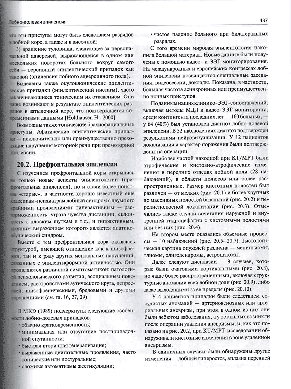 Пример страницы из книги "Эпилепсия у детей и взрослых женщин и мужчин. Руководство для врачей" - Карлов В. А.