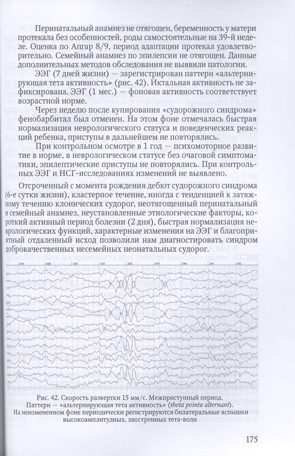 Пример страницы из книги "Эпилептические и неэпилептические синдромы у детей грудного возраста. Принципы диагностики и лечения" - Понятишин А. Е.