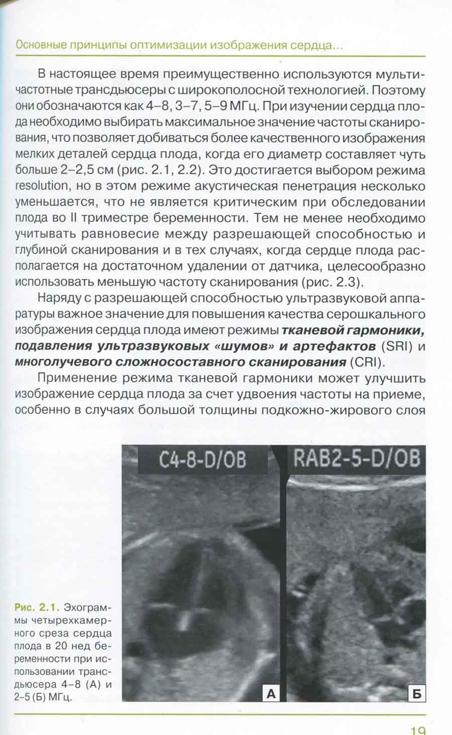 Рис. 2.1. Эхограммы четырехкамерного среза сердца плода в 20 нед бе- Рис. 2.1. Эхограммы четырехкамерного среза сердца плода в 20 нед бе-