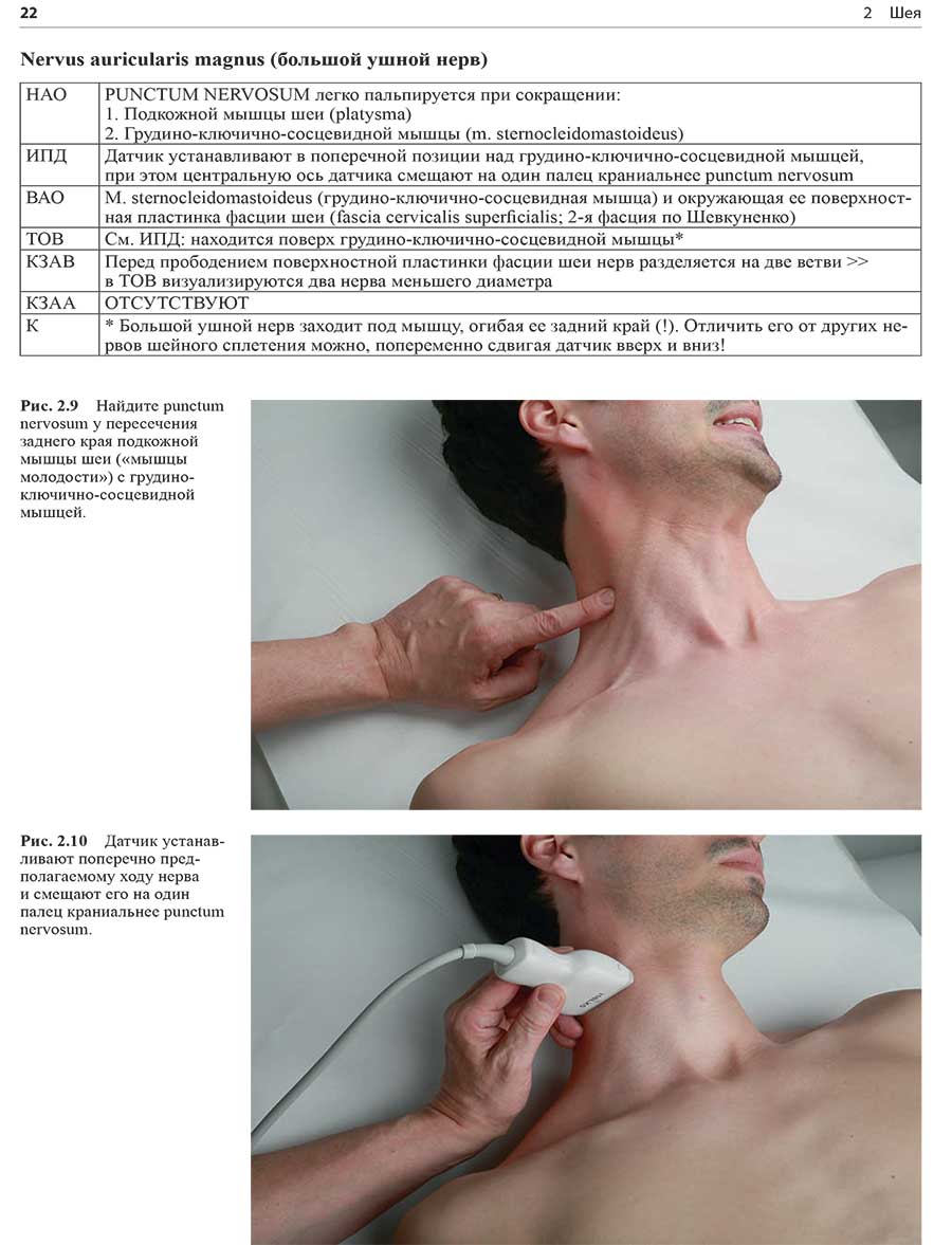 Рис. 2.9 Найдите punctum nervosum у пересечения заднего края подкожной мышцы шеи («мышцы молодости») с грудино-ключично-сосцевидной мышцей.
